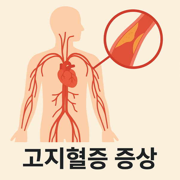 고지혈증으로 인한 동맥 내 플라크를 보여주는 심혈관계 일러스트